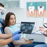 Why You Should Pause Before Your Next Cavity Filling