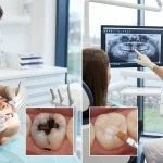 Why a Second Opinion Might Save Your Teeth (and Money)